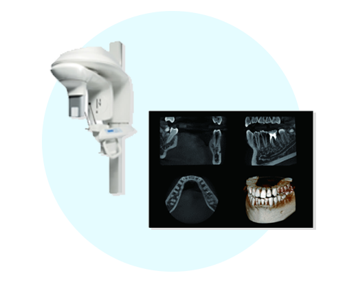 精度の高い「歯科用CTスキャン」を採用